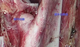 解剖吃瓜事件图片大全,揭秘人体器官的趣味解剖图集