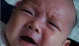 湿疹可以吃小瓜吗,湿疹患者适宜食用小瓜的探讨